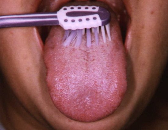 brushing_your_tongue-1568294